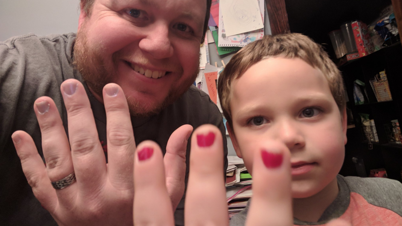Dad Goes to Bat for Son When He's Shamed for Painting His Nails