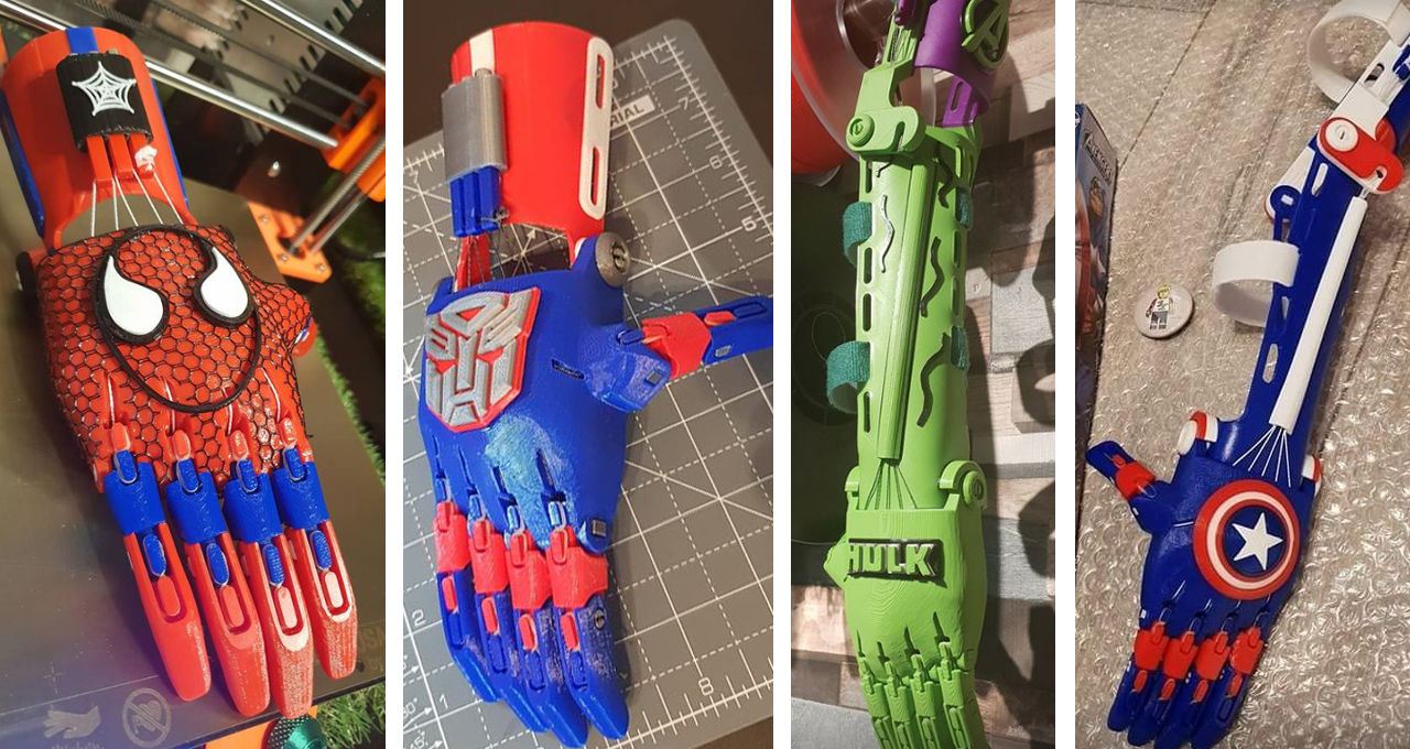 Dad 3D Prints Prosthetic Superhero Limbs for Kids