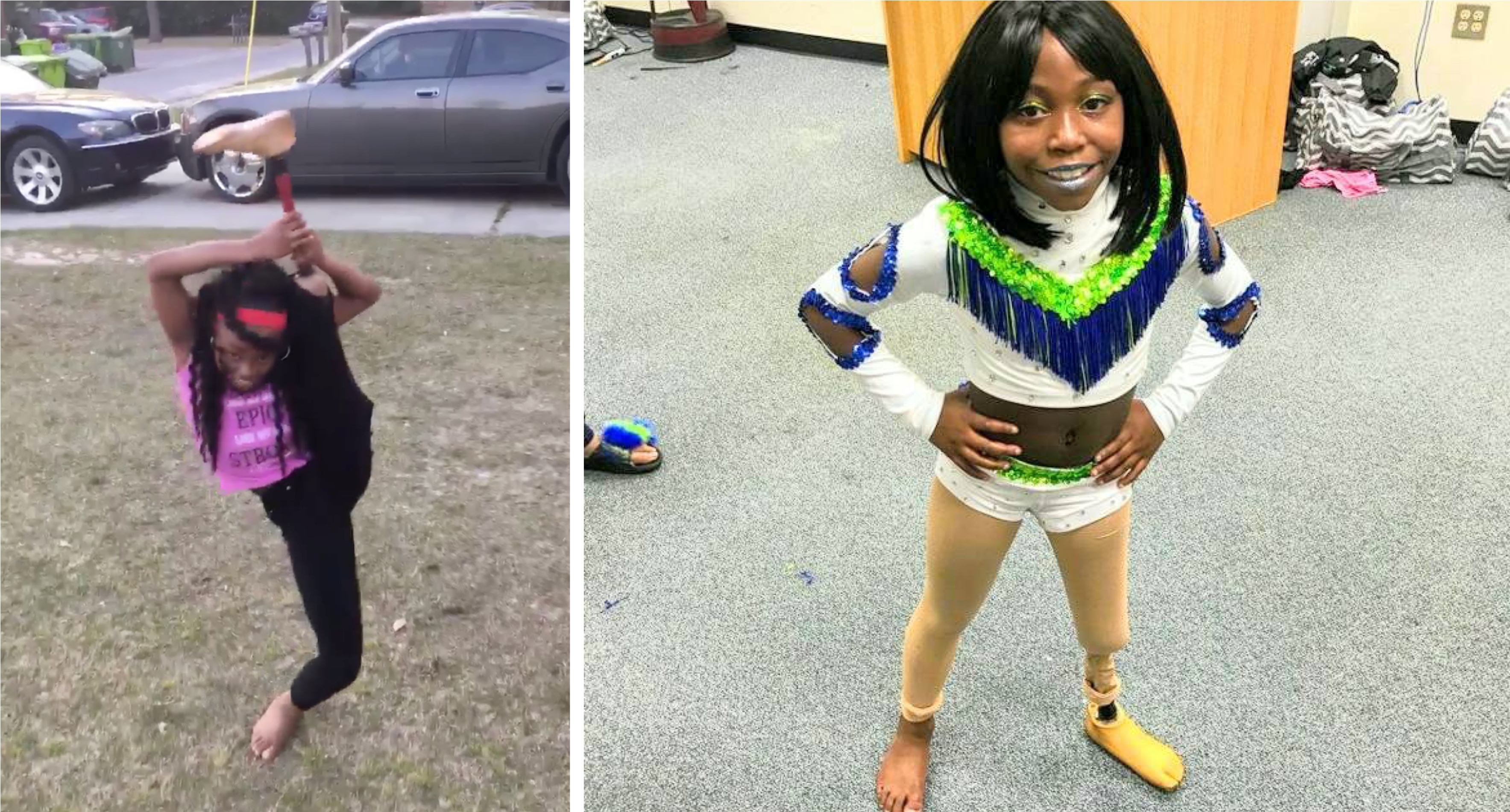 10-Year-Old Gymnast with Prosthetic Leg Goes Viral