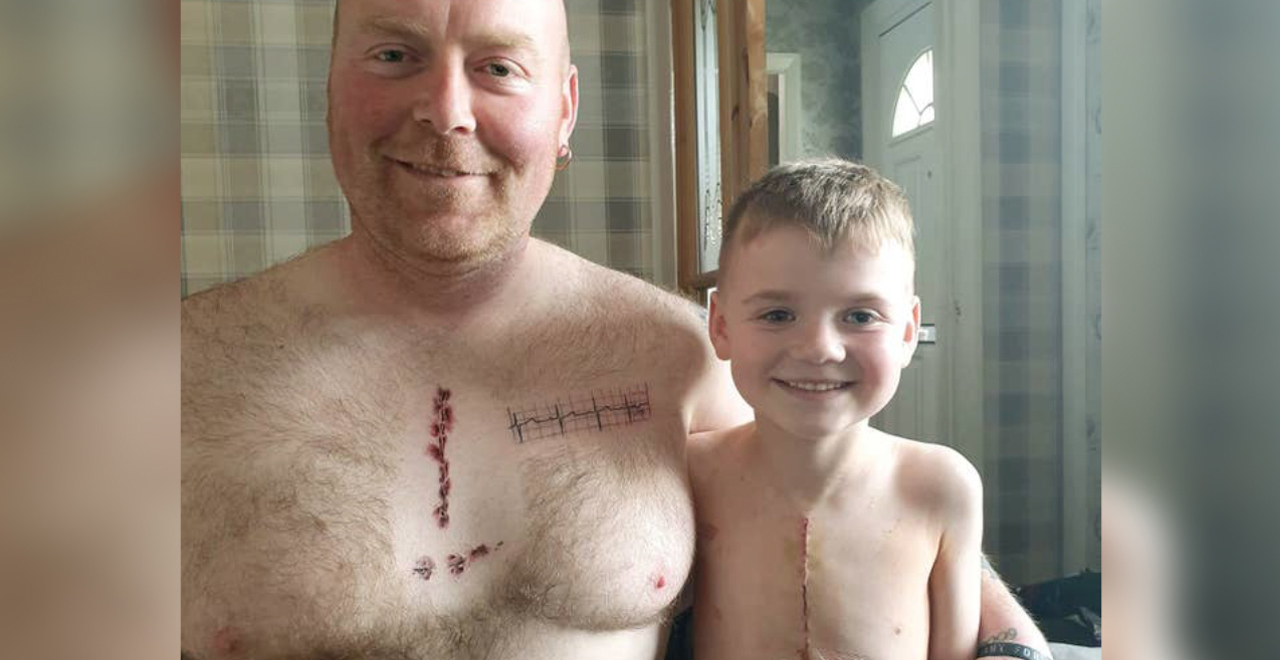 Dad Gets Matching Scar Tattoo