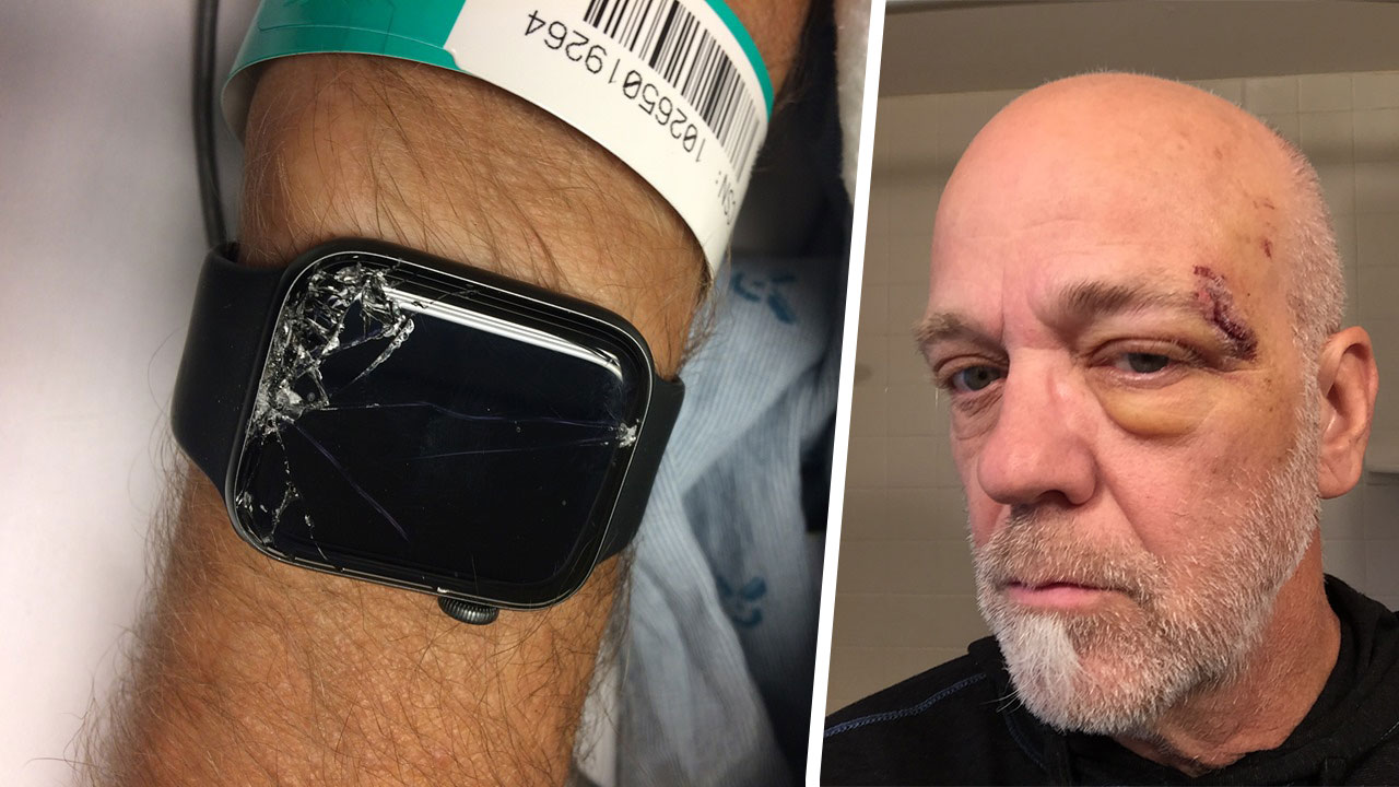 Son Says Apple Watch Helped Save Dad's Life After Serious Fall