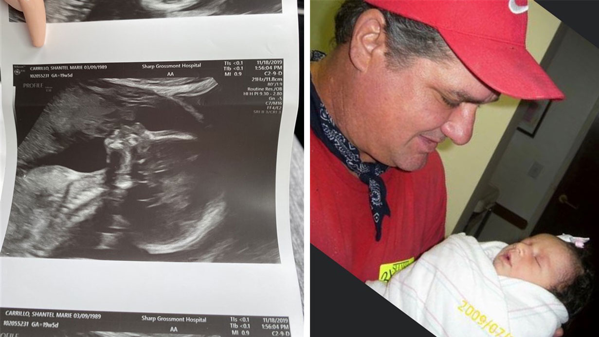 Ultrasound Appears to Show Woman's Late Father Kissing Baby