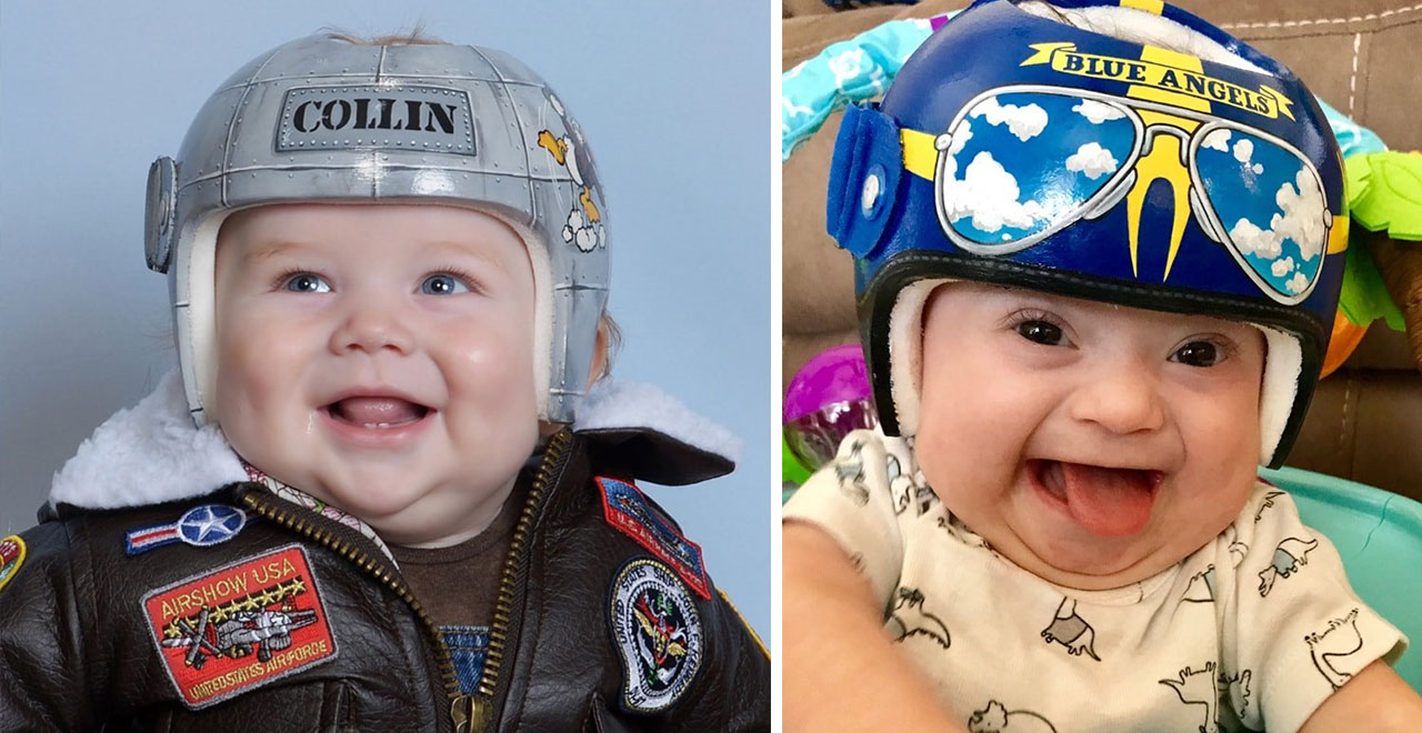 Artist Turns Infant Medical Helmets Into Works of Art