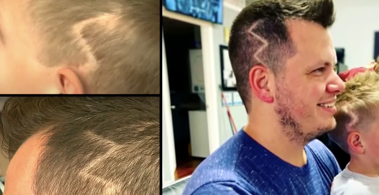 Dad cuts lightning bolt into hair to match son's scar