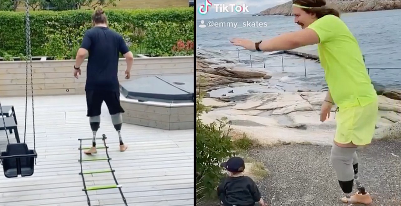 Dad has legs amputates so he can run around with his son