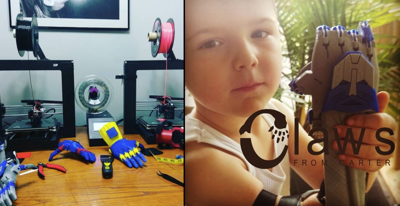 Dad 3D Prints prosthetics for free