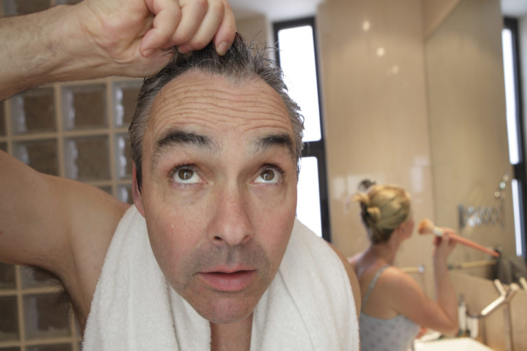 7 Myths About Losing Your Hair