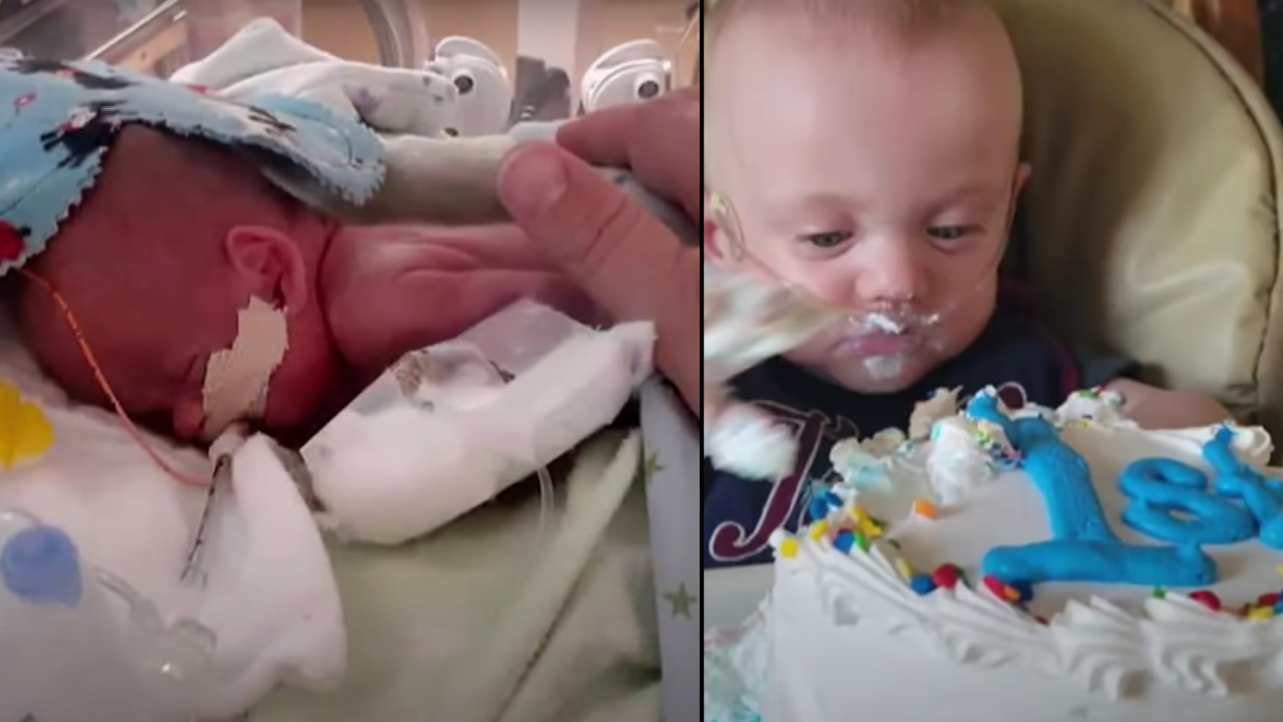 World's most premature baby celebrates first birthday
